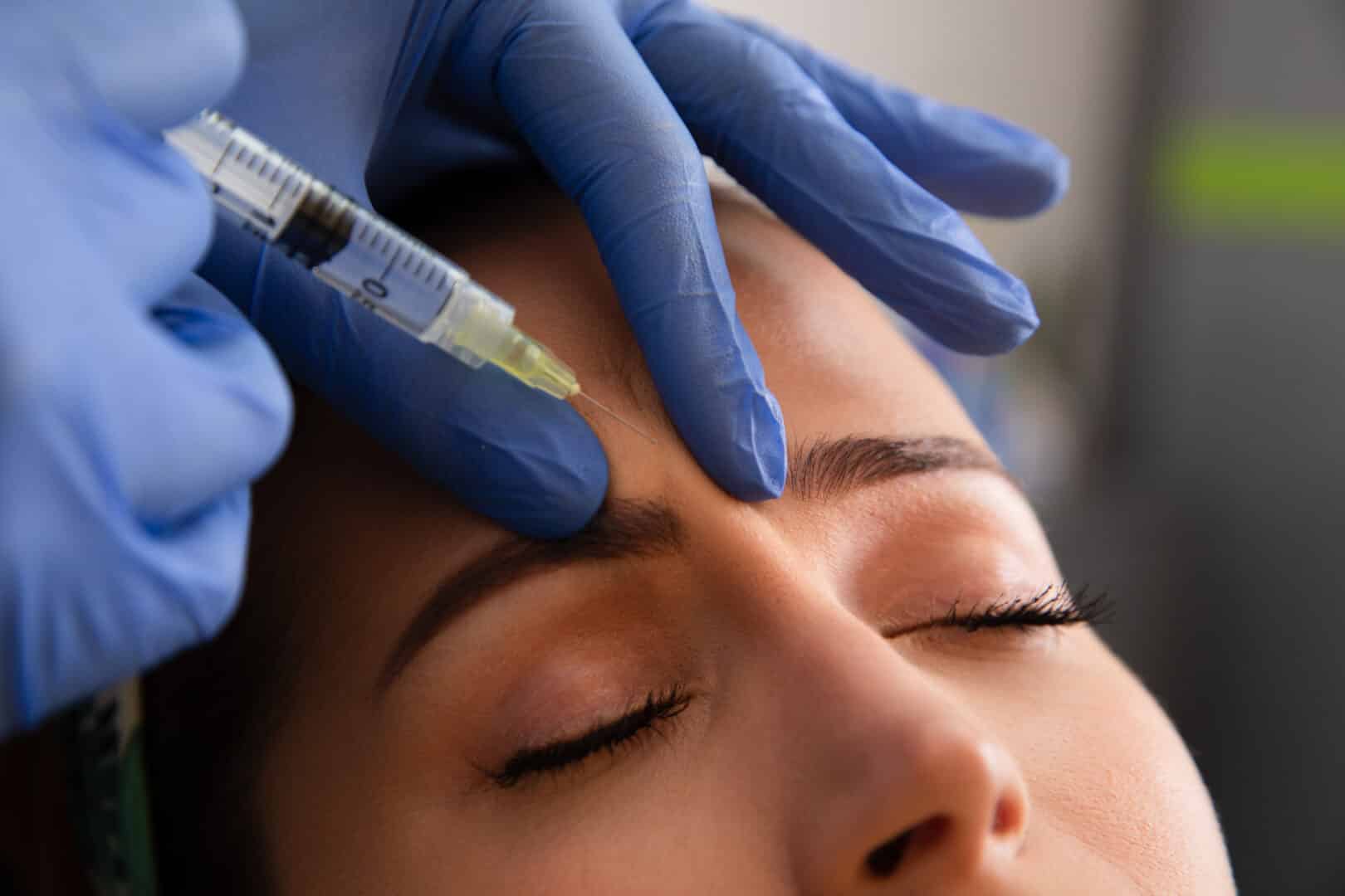 botox treatment for migraines